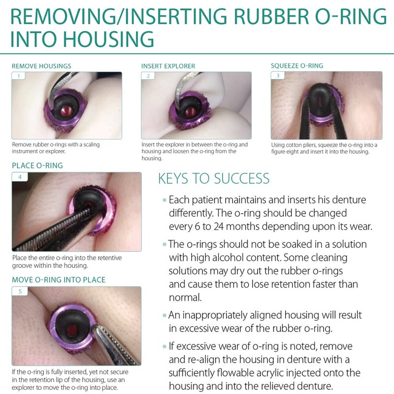 FUSHIPRO Micro Replacement O Ring Kit, for Sterngold Mini Implant Fits a 2.2mm 1.8mm Ball Housing Black - Image 3